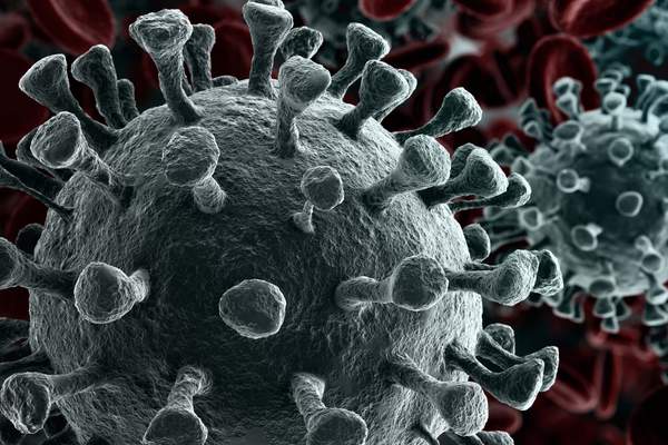 Making a COVID-19 related WorkCover claim